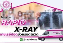 มูลนิธิโรงพยาบาลราชวิถีและภาคประชาสังคม จัดโครงการ Rapid X-Ray เอกซเรย์ปอดช่วยรอดโควิด ฟรี!